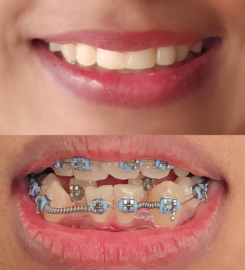 Best Dental Clinic Al Rigga, Dubai